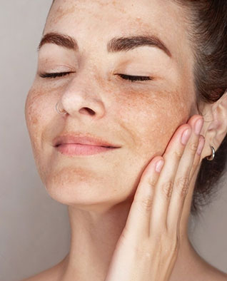 skin Rashes Treatment in Chandigarh