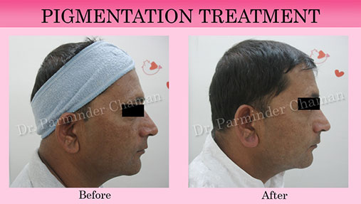 Top Dermatologist in Chandigarh